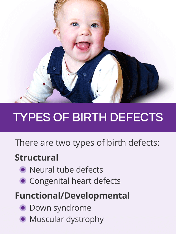 Types of birth defects