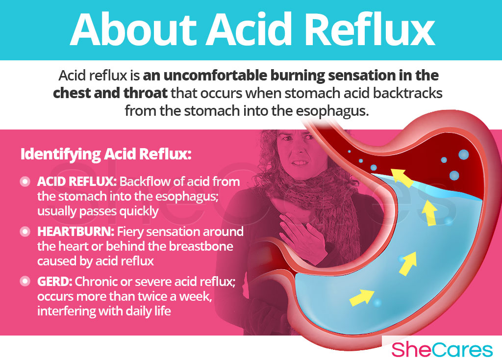 About Acid Reflux