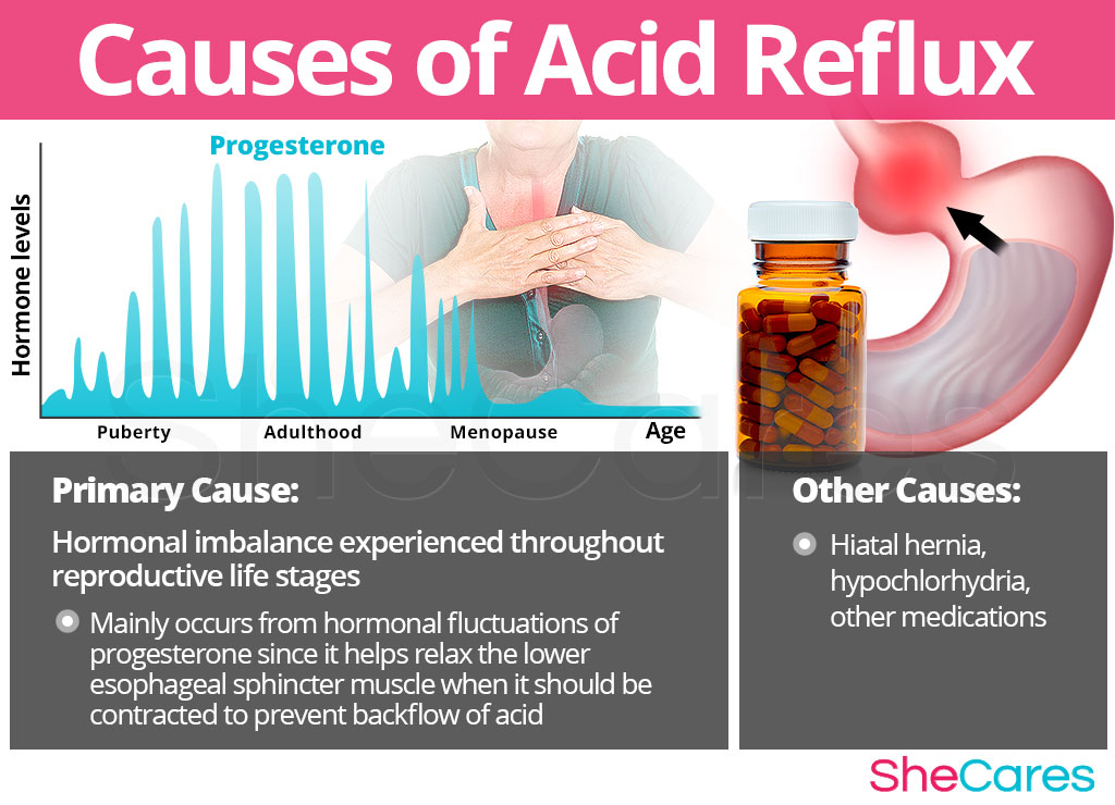 Causes of Acid Reflux