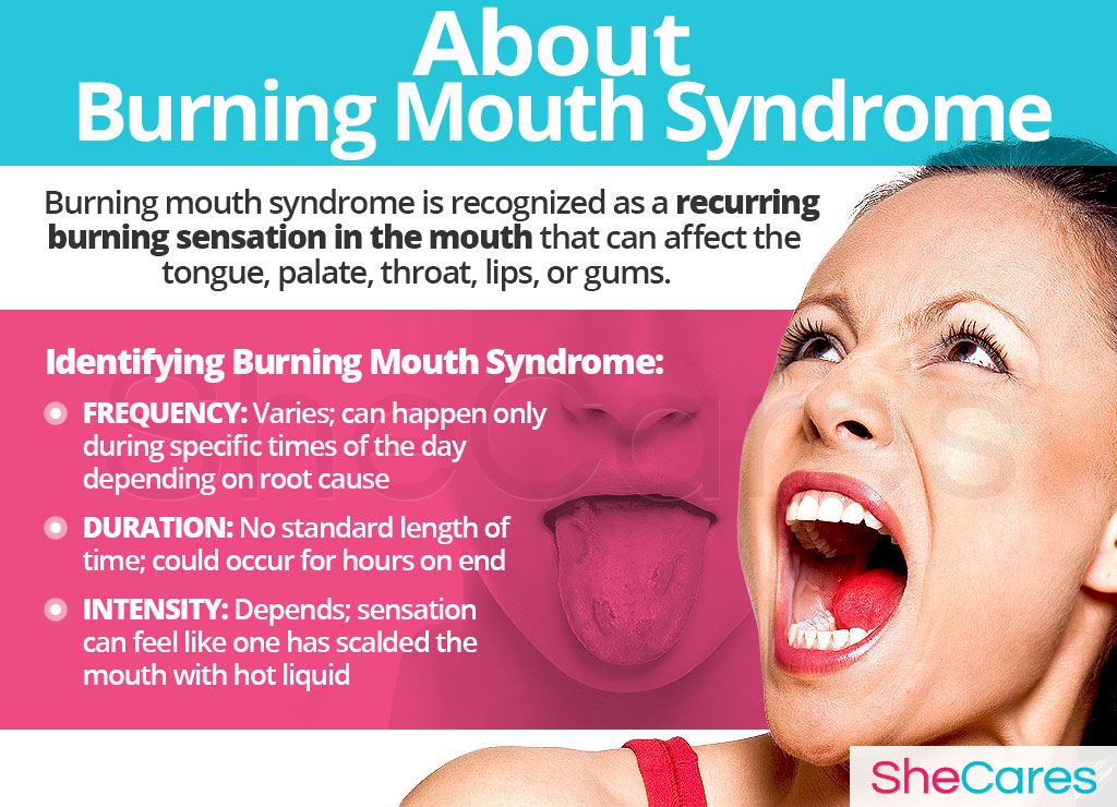 About Burning Mouth Syndrome