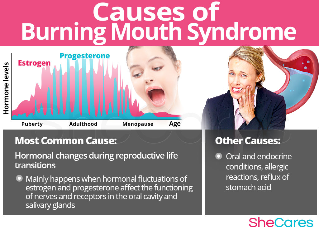 Causes of Burning Mouth Syndrome