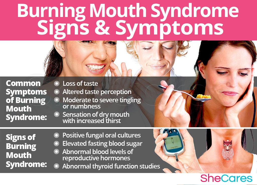 Burning Mouth Syndrome - Signs and Symptoms