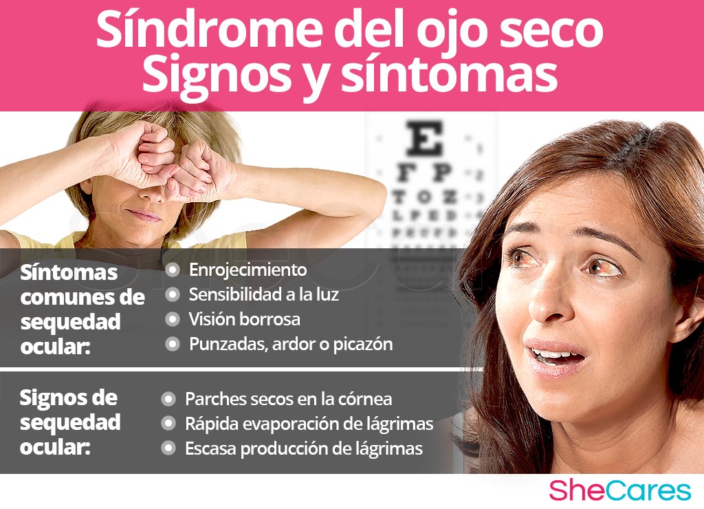 Signos y síntomas de ojo seco