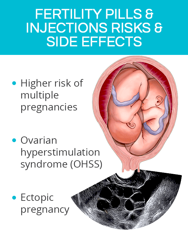 Fertility pills and injections side effects