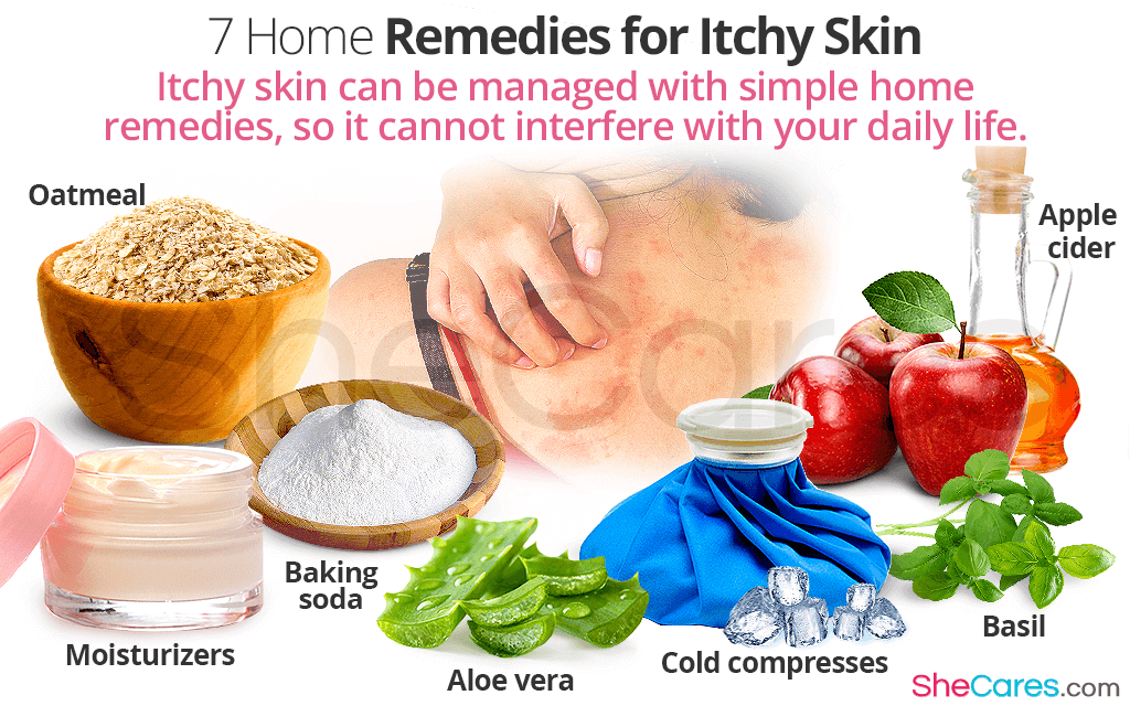 Home remedies for itchy skin