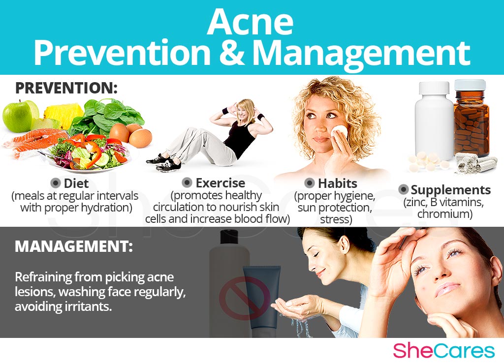 Acne - Prevention and Management