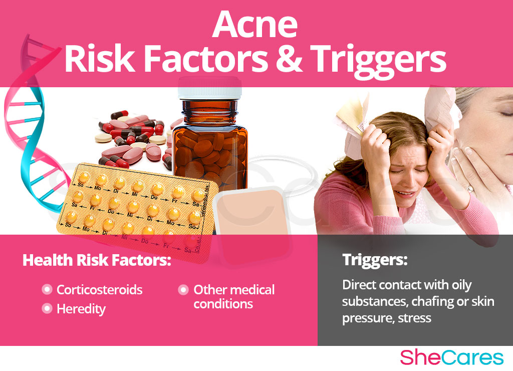 Acne - Risk Factors and Triggers