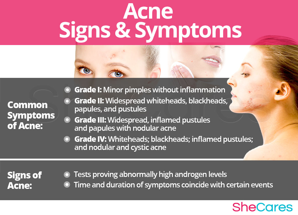 Acne - Signs and Symptoms