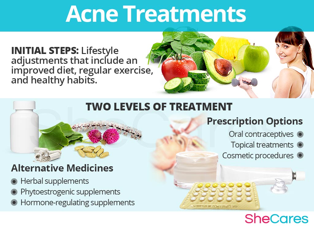 Acne Treatments