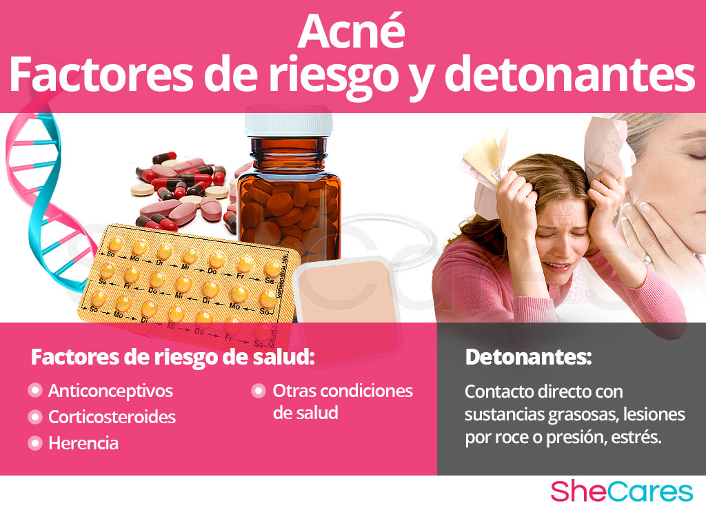 Acné - Factores de riesgo y detonantes