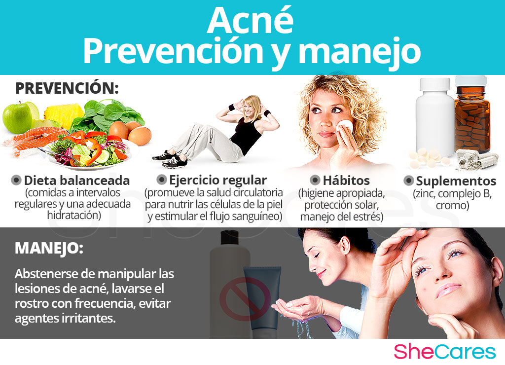 Acné - Prevención y manejo