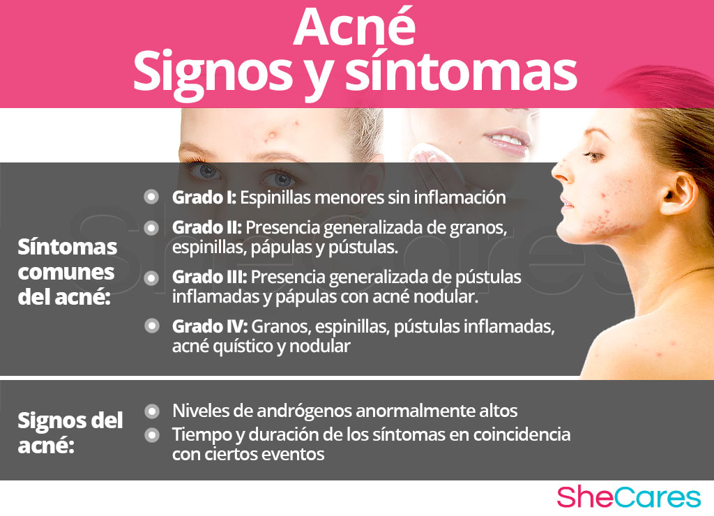 Acné - Signos y síntomas