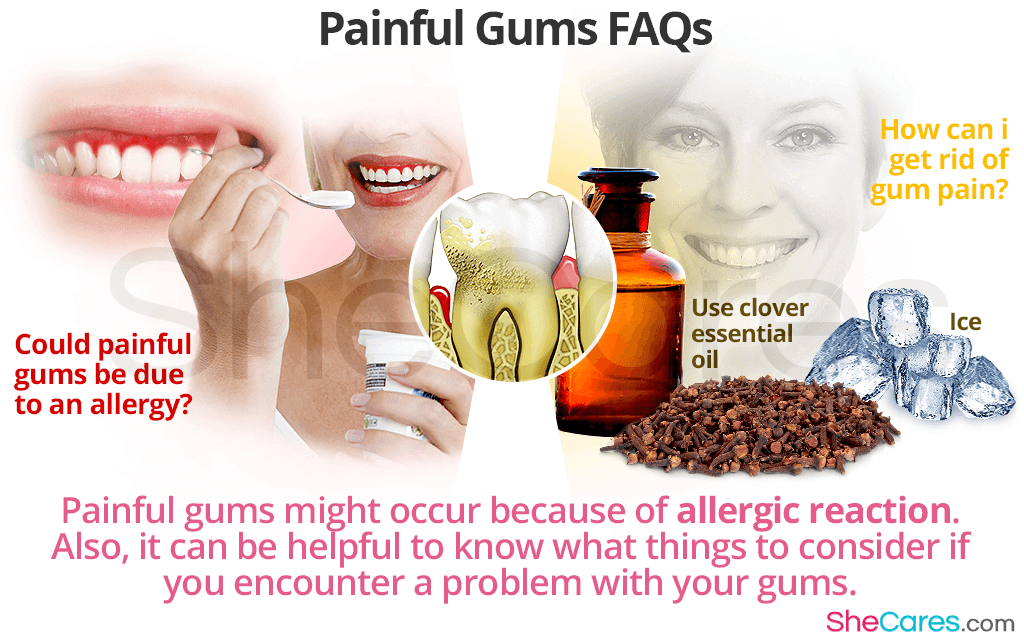 Painful Gums FAQs