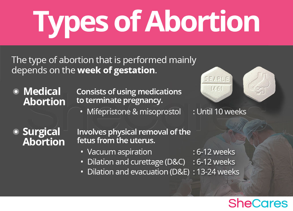 Types of Abortion