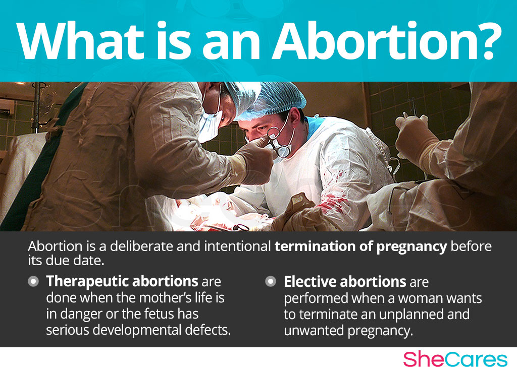 What is an abortion