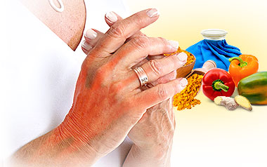 Joint Stiffness FAQs