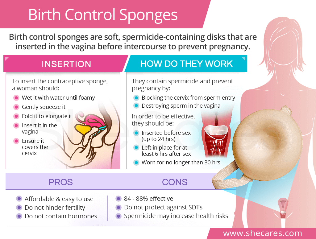 Birth control sponges