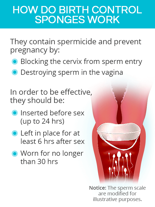 How do birth control sponges work