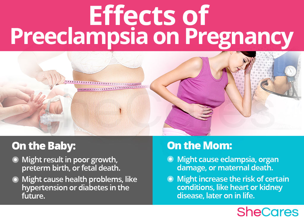 Effects of Preeclampsia on Pregnancy