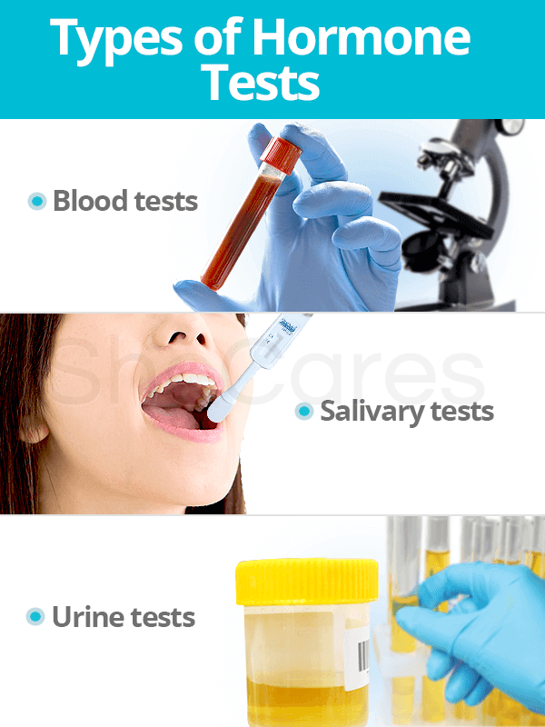 How to test progesterone levels