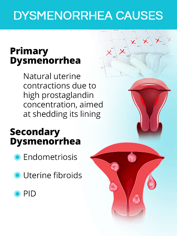 Dysmenorrhea causes