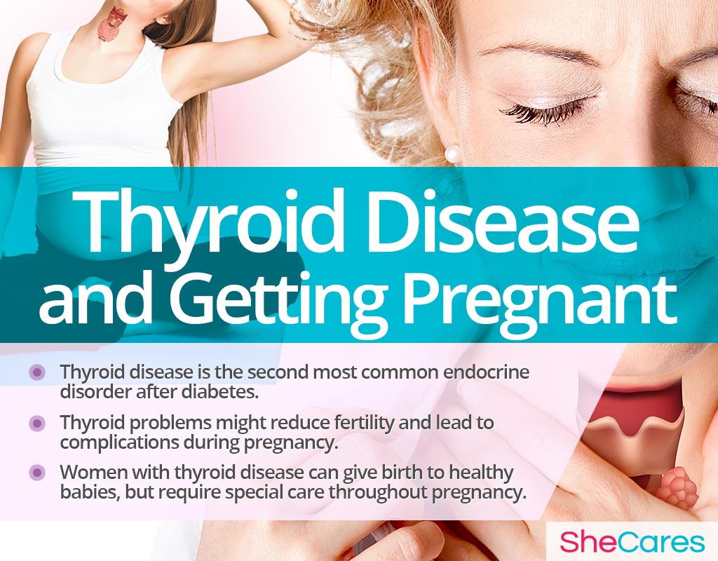 Thyroid Disease and Getting Pregnant
