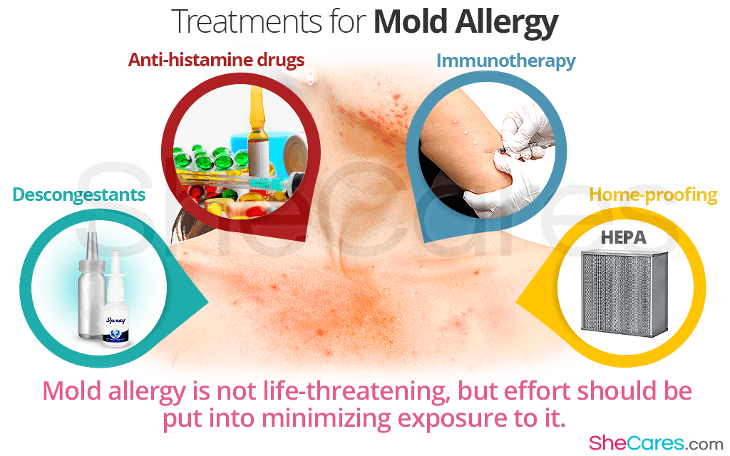 Treatments for Mold Allergy