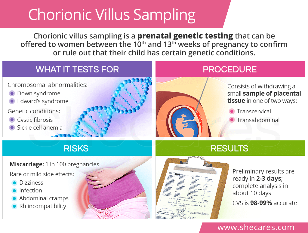 Chorionic villus sampling