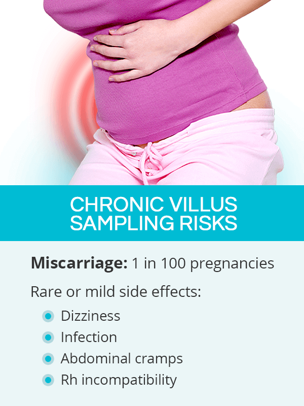 Chorionic villus sampling risks