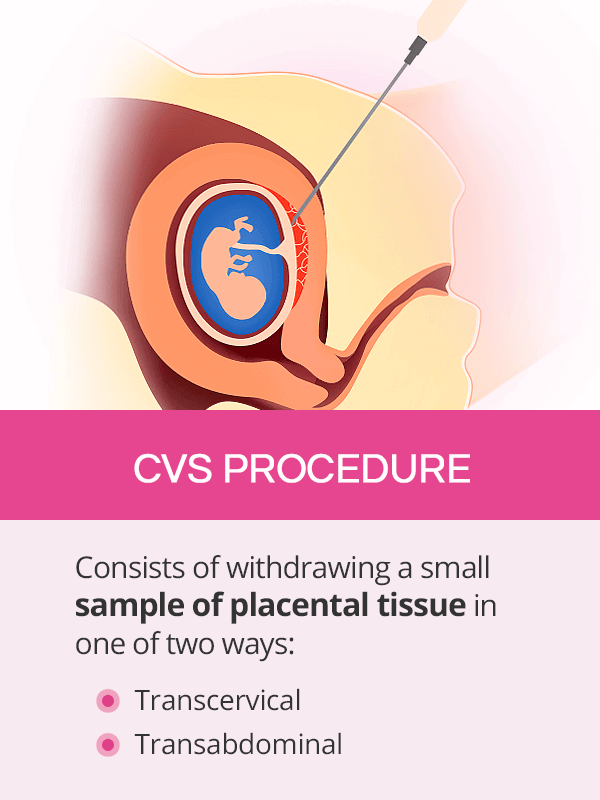 CVS procedure