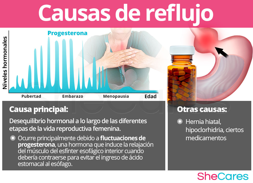 Causas de reflujo