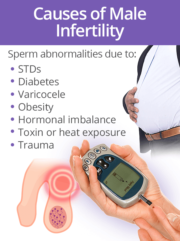 Male infertility causes