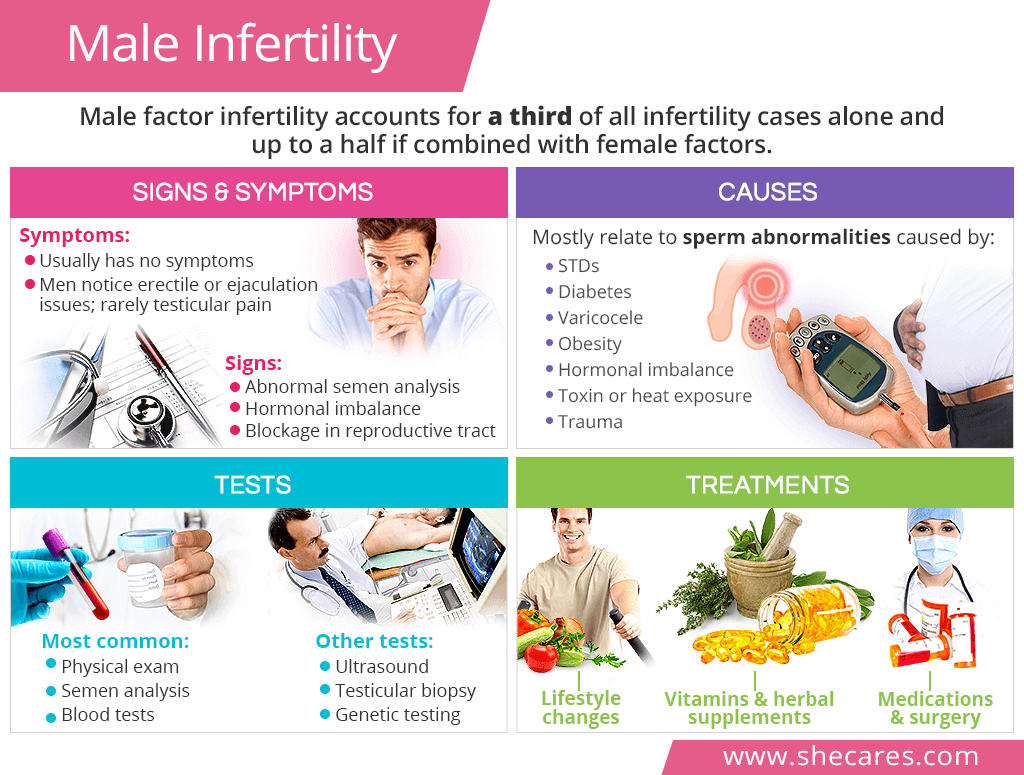 Male Infertility