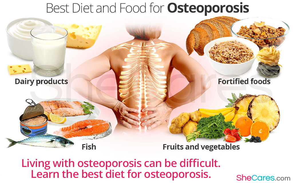 Living with osteoporosis can be difficult. Learn the best diet for osteoporosis.
