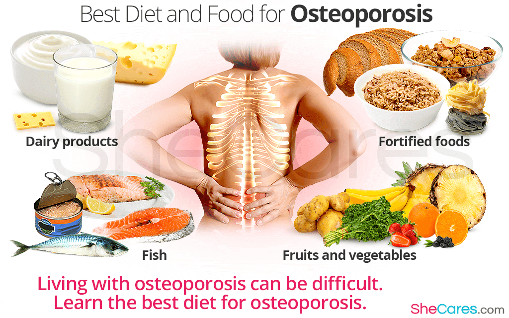 Best Diet and Foods for Osteoporosis | SheCares