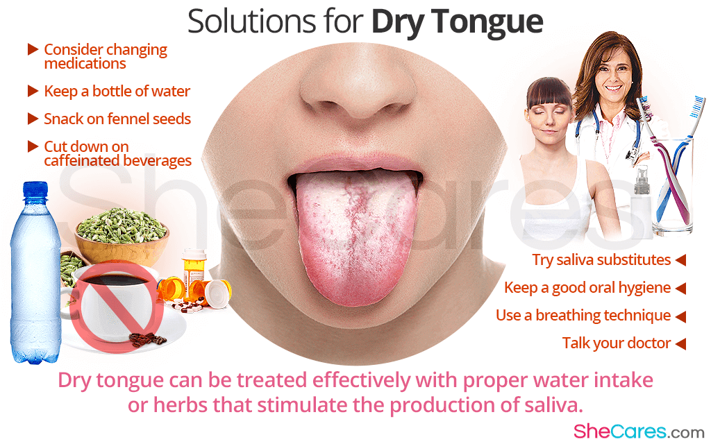 dry tongue