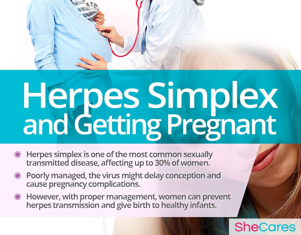 Herpes Simplex and Getting Pregnant