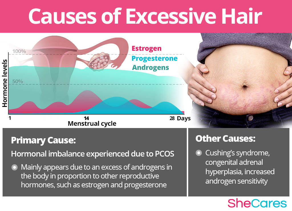 Causes of Excessive Hair