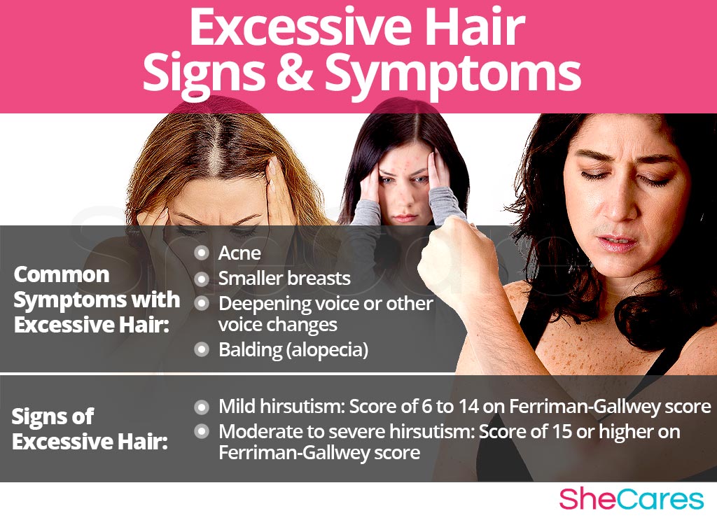 Excessive Hair - Signs and Symptoms