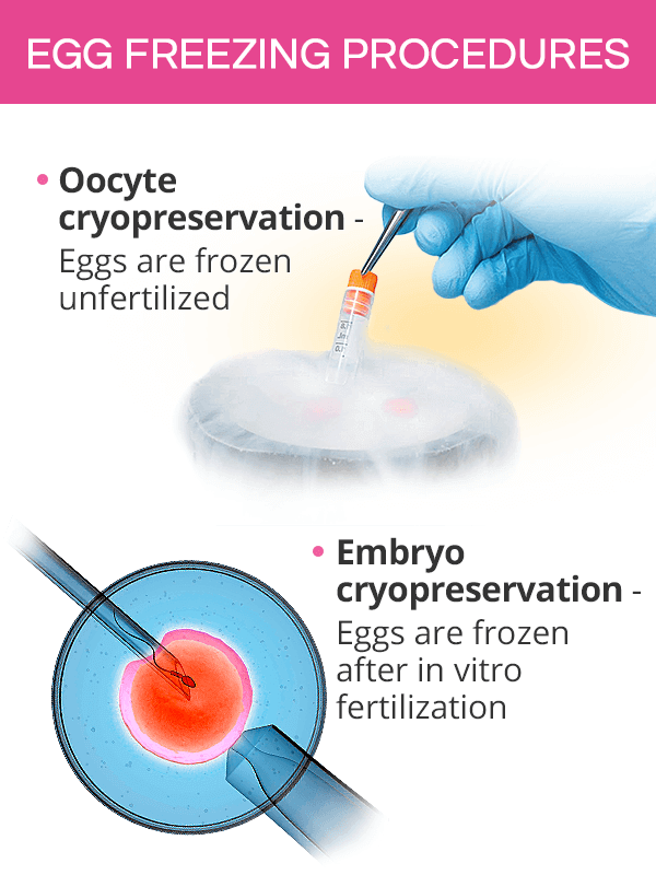 Egg freezing procedures