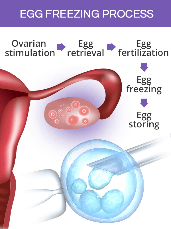 Egg freezing process