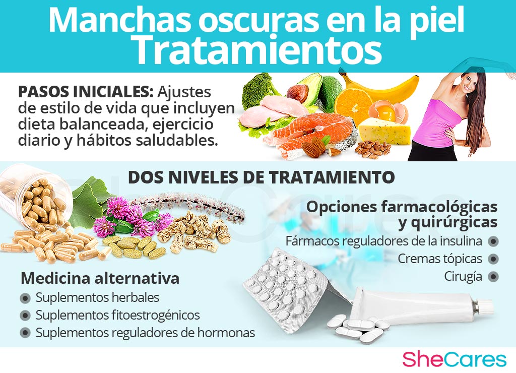 Tratamientos para las manchas oscuras en la piel