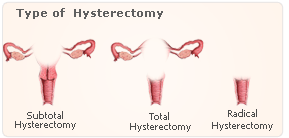 estrogen ovarian