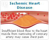 Ischemic heart disease