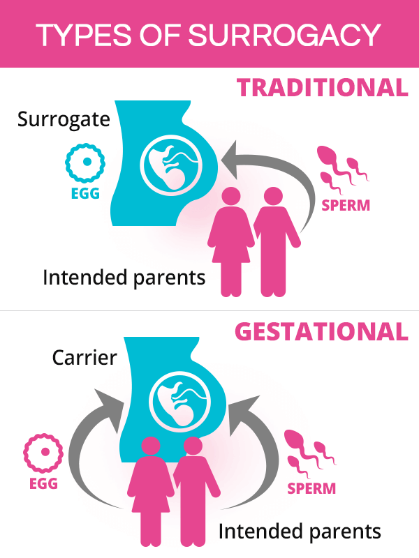 Types of surrogacy
