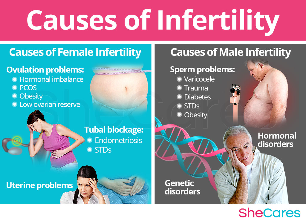 Causes of Infertility