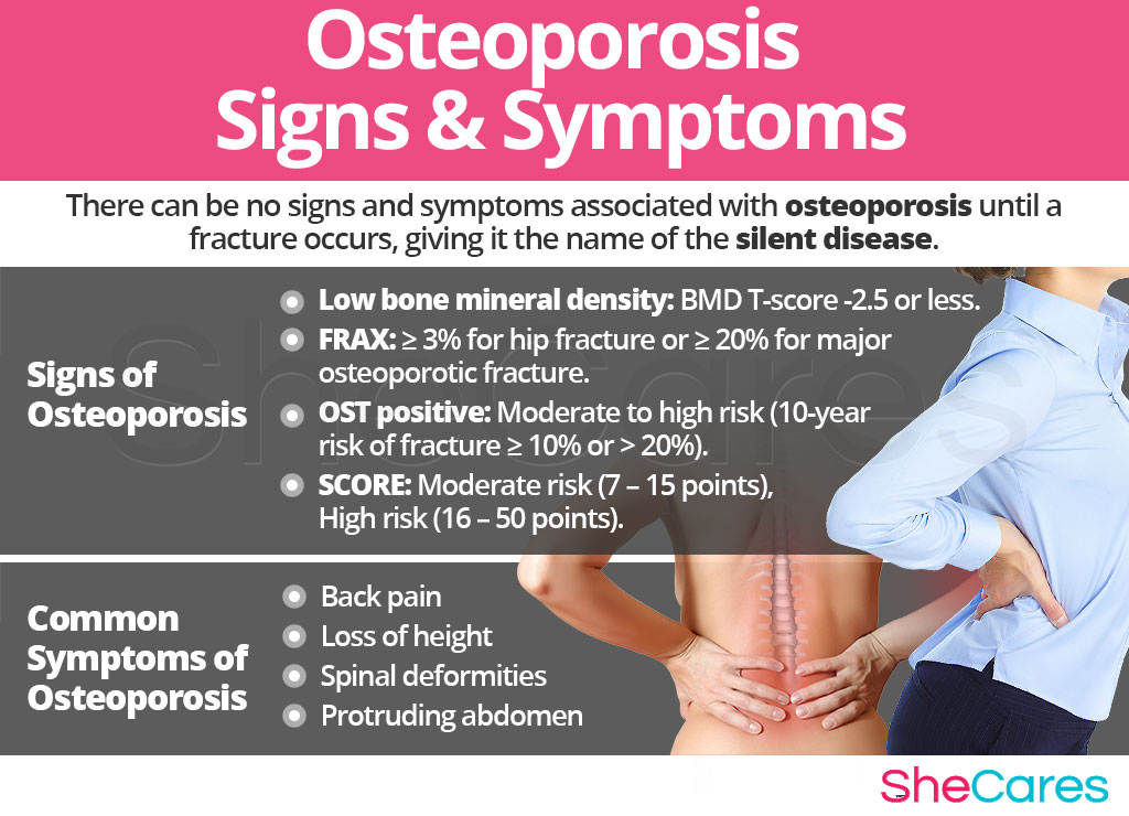 Signs and Symptoms of Osteoporosis