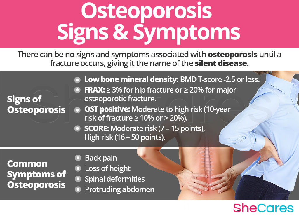 El mejor alimento para la osteoporosis