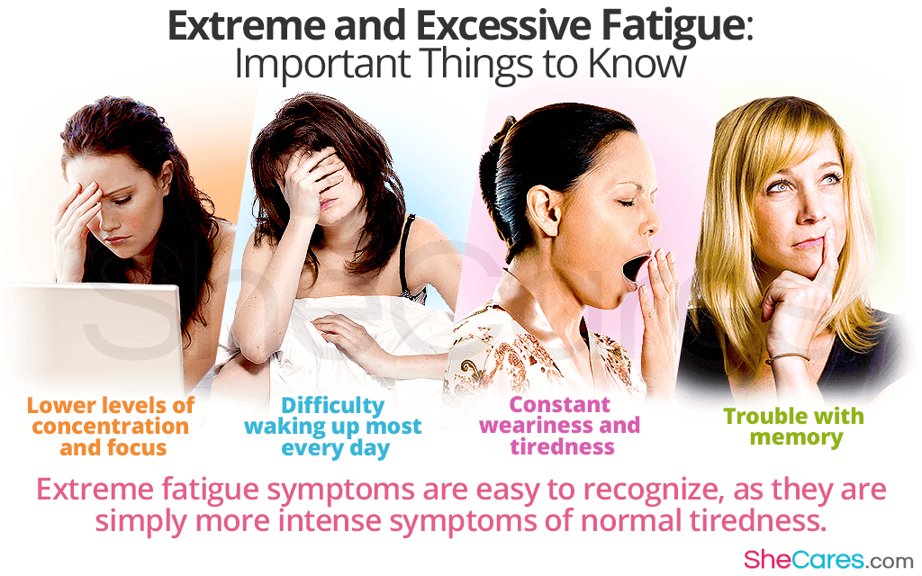 Extreme and Excessive Fatigue: Important Things to Know