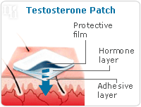 Testosterone patch